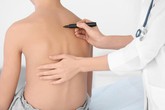 Cơ hội tốt cho trẻ cong vẹo cột sống được khám và tư vấn phẫu thuật với các chuyên gia hàng đầu Hoa Kỳ Cơ hội tốt cho trẻ cong vẹo cột sống được khám và tư vấn phẫu thuật với các chuyên gia hàng đầu Hoa Kỳ