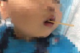 Từ vụ bé 3 tuổi suýt mất mạng khi ăn xúc xích, chuyên gia khuyên gì về món khoái khẩu này Từ vụ bé 3 tuổi suýt mất mạng khi ăn xúc xích, chuyên gia khuyên gì về món khoái khẩu này