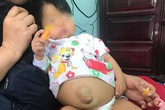 Bé gái 14 tháng tuổi bị xơ gan, bà ngoại bỏ xạ trị ung thư để cứu cháu Bé gái 14 tháng tuổi bị xơ gan, bà ngoại bỏ xạ trị ung thư để cứu cháu