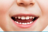 Lấy gần 100 cái răng trong miệng thiếu niên ở Khánh Hòa Lấy gần 100 cái răng trong miệng thiếu niên ở Khánh Hòa