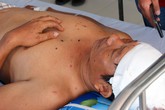 Công nhân kể phút bị hất văng khỏi lán trại sau tiếng nổ lớn Công nhân kể phút bị hất văng khỏi lán trại sau tiếng nổ lớn