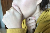 Cô gái 21 tuổi chỉ sống được 5 ngày sau khi phát hiện bị ung thư: Cảnh báo dấu hiệu ai cũng phải chú ý Cô gái 21 tuổi chỉ sống được 5 ngày sau khi phát hiện bị ung thư: Cảnh báo dấu hiệu ai cũng phải chú ý