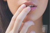 "Nụ hôn thần chết" không chỉ đe dọa trẻ em, qua nụ hôn người lớn cũng có thể bị bệnh tình dục nguy hiểm "Nụ hôn thần chết" không chỉ đe dọa trẻ em, qua nụ hôn người lớn cũng có thể bị bệnh tình dục nguy hiểm