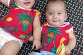 Rớt nước mắt hoàn cảnh bé sinh đôi mắc bệnh tim phức tạp cần phẫu thuật gấp Rớt nước mắt hoàn cảnh bé sinh đôi mắc bệnh tim phức tạp cần phẫu thuật gấp