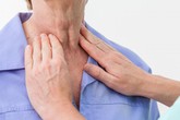 Dấu hiệu cảnh báo sớm ung thư vòm mũi họng - loại ung thư hàng đầu vùng đầu cổ Dấu hiệu cảnh báo sớm ung thư vòm mũi họng - loại ung thư hàng đầu vùng đầu cổ