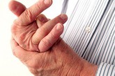 Biến chứng nguy hiểm của bệnh VIÊM KHỚP và biện pháp khắc phục hiệu quả Biến chứng nguy hiểm của bệnh VIÊM KHỚP và biện pháp khắc phục hiệu quả