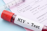 Xét nghiệm chẩn đoán HIV Xét nghiệm chẩn đoán HIV