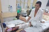Vừa mất vợ vì tai nạn giao thông, người đàn ông bất hạnh lại có nguy cơ mất chân vì không tiền điều trị Vừa mất vợ vì tai nạn giao thông, người đàn ông bất hạnh lại có nguy cơ mất chân vì không tiền điều trị