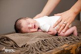 Nguyên nhân gây vẹo cổ bẩm sinh Nguyên nhân gây vẹo cổ bẩm sinh