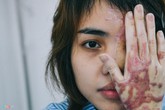 Người bán axit cho cựu thiếu úy công an: 'Tôi rất sốc' Người bán axit cho cựu thiếu úy công an: 'Tôi rất sốc'