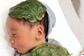 Từ trường hợp bé sơ sinh bị bỏng da do đắp lá trầu không, chuyên gia cảnh báo không tự ý dùng trầu không chữa bệnh Từ trường hợp bé sơ sinh bị bỏng da do đắp lá trầu không, chuyên gia cảnh báo không tự ý dùng trầu không chữa bệnh