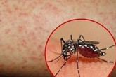 Quên điều này, bạn tự rước bệnh chết người vào chính mình và người thân Quên điều này, bạn tự rước bệnh chết người vào chính mình và người thân