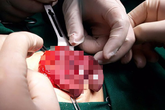Bé gái 6 ngày tuổi đã phải cắt buồng trứng Bé gái 6 ngày tuổi đã phải cắt buồng trứng