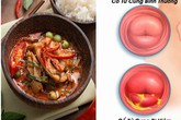 5 thực phẩm 'nuôi' khối u xơ lớn mỗi ngày, là mối nguy hại với tử cung 5 thực phẩm 'nuôi' khối u xơ lớn mỗi ngày, là mối nguy hại với tử cung