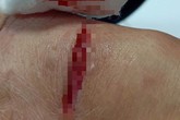 Người dân lao vào đập chết con chó cắn bị thương nhiều người giữa chợ Người dân lao vào đập chết con chó cắn bị thương nhiều người giữa chợ