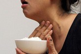 Có 6 triệu chứng sau bữa ăn là tiền thân của nhiều bệnh nguy hiểm Có 6 triệu chứng sau bữa ăn là tiền thân của nhiều bệnh nguy hiểm