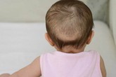 Bác sĩ dinh dưỡng giải đáp 5 "truyền thuyết" về bổ sung canxi và vitamin D cho trẻ Bác sĩ dinh dưỡng giải đáp 5 "truyền thuyết" về bổ sung canxi và vitamin D cho trẻ