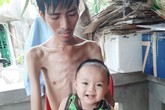 Đau xót cảnh người cha cố duy trì sự sống để chờ hiến thận cho con Đau xót cảnh người cha cố duy trì sự sống để chờ hiến thận cho con