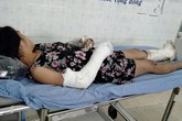 Thai phụ bị chồng đánh vỡ nền sọ, gãy tay bất ngờ trốn viện Thai phụ bị chồng đánh vỡ nền sọ, gãy tay bất ngờ trốn viện