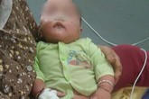 Uống kháng sinh mẹ tự mua, bé 8 tháng tuổi suýt chết Uống kháng sinh mẹ tự mua, bé 8 tháng tuổi suýt chết