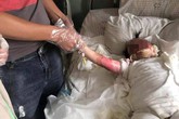 Bé 2 tuổi ngã vào chảo dầu sôi, hành động tưởng cứu nguy của cha mẹ hóa ra hại con Bé 2 tuổi ngã vào chảo dầu sôi, hành động tưởng cứu nguy của cha mẹ hóa ra hại con