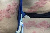 Mưa nắng thất thường, bệnh có thể gây dị tật thai nhi gia tăng, BS chỉ cách phòng đơn giản Mưa nắng thất thường, bệnh có thể gây dị tật thai nhi gia tăng, BS chỉ cách phòng đơn giản