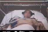 Phẫu thuật gọt cằm và cắt mí, cô gái trẻ hôn mê 5 tháng chưa tỉnh Phẫu thuật gọt cằm và cắt mí, cô gái trẻ hôn mê 5 tháng chưa tỉnh