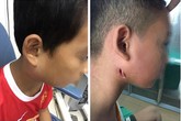 Phòng bệnh whitmore "ăn thịt người": Người dân cần làm tốt những việc này Phòng bệnh whitmore "ăn thịt người": Người dân cần làm tốt những việc này