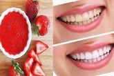 Mẹo loại bỏ các mảng bám trên răng giúp hàm răng trở nên trắng sáng của quả dâu tây Mẹo loại bỏ các mảng bám trên răng giúp hàm răng trở nên trắng sáng của quả dâu tây