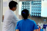 Ca đầu tiên ở Việt Nam bị xuất huyết não sau khi "chơi" ma tuý đá Ca đầu tiên ở Việt Nam bị xuất huyết não sau khi "chơi" ma tuý đá