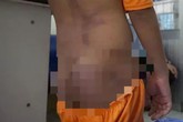 Không khởi tố vụ 4 cháu nhỏ bị bạo hành ở Cà Mau Không khởi tố vụ 4 cháu nhỏ bị bạo hành ở Cà Mau