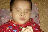 Thắt lòng trước cảnh bé 3 tuổi không mở được mắt, chưa biết nói, biết đi Thắt lòng trước cảnh bé 3 tuổi không mở được mắt, chưa biết nói, biết đi