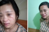 Thông tin mới nhất vụ thai phụ 8 tháng bị chồng đánh vì dùng 135 ngàn để mua giày online Thông tin mới nhất vụ thai phụ 8 tháng bị chồng đánh vì dùng 135 ngàn để mua giày online