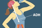 Điều trị đái tháo nhạt Điều trị đái tháo nhạt