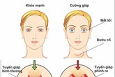 11 biến chứng suy tuyến giáp nguy hiểm khôn lường cần biết 11 biến chứng suy tuyến giáp nguy hiểm khôn lường cần biết