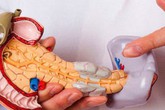 Cảnh báo bệnh ung thư ác tính nhất đường tiêu hoá, chỉ 4% người mắc sống sót được 5 năm Cảnh báo bệnh ung thư ác tính nhất đường tiêu hoá, chỉ 4% người mắc sống sót được 5 năm