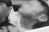 Sống với mẹ nhưng tối nào cũng phải sang cho bố chăm sóc, bé gái hơn 1 tuổi bất ngờ nhập viện trong tình trạng toàn thân tổn thương nghiêm trọng Sống với mẹ nhưng tối nào cũng phải sang cho bố chăm sóc, bé gái hơn 1 tuổi bất ngờ nhập viện trong tình trạng toàn thân tổn thương nghiêm trọng