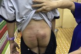 TPHCM: Nghi vấn bé trai bị bạo hành kéo dài khi ở cùng bố, mẹ kế TPHCM: Nghi vấn bé trai bị bạo hành kéo dài khi ở cùng bố, mẹ kế