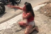 Phẫn nộ: Cô gái bị người tình cũ rạch mặt tàn ác Phẫn nộ: Cô gái bị người tình cũ rạch mặt tàn ác
