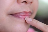 4 dấu hiệu trên khuôn mặt cảnh báo gan đang kêu cứu 4 dấu hiệu trên khuôn mặt cảnh báo gan đang kêu cứu