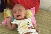 Căn bệnh chú lính chì Phạm Đức Lộc mắc suốt 3 năm qua có thể điều trị khỏi Căn bệnh chú lính chì Phạm Đức Lộc mắc suốt 3 năm qua có thể điều trị khỏi