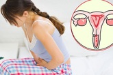 Từ trường hợp cô gái 22 tuổi mắc ung thư cổ tử cung vì thói quen quan hệ cả khi "đèn đỏ", khuyến cáo điều đặc biệt quan trọng phụ nữ cần ghi nhớ Từ trường hợp cô gái 22 tuổi mắc ung thư cổ tử cung vì thói quen quan hệ cả khi "đèn đỏ", khuyến cáo điều đặc biệt quan trọng phụ nữ cần ghi nhớ