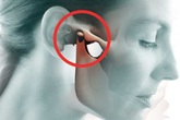 Thói quen nghe điện thoại này có thể khiến bạn mắc loại bệnh nhiều người mắc mà không biết Thói quen nghe điện thoại này có thể khiến bạn mắc loại bệnh nhiều người mắc mà không biết