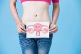 Trước khi phụ nữ bị ung thư buồng trứng, cơ thể sẽ đưa ra 2 báo hiệu này Trước khi phụ nữ bị ung thư buồng trứng, cơ thể sẽ đưa ra 2 báo hiệu này