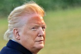 Ảnh Tổng thống Trump 'cháy nắng' gây bão mạng Ảnh Tổng thống Trump 'cháy nắng' gây bão mạng