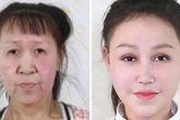 Màn lột xác của cô bé 15 tuổi nhưng mặt nhăn nheo, chảy xệ như cụ già 60 tuổi Màn lột xác của cô bé 15 tuổi nhưng mặt nhăn nheo, chảy xệ như cụ già 60 tuổi