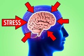 Stress có thể khiến não bạn bị teo nhỏ và đây là cách ngăn chặn Stress có thể khiến não bạn bị teo nhỏ và đây là cách ngăn chặn