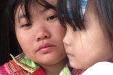 Bé gái 3 tuổi ở vùng cao đang chờ mổ lần cuối tái tạo hậu môn mà gia đình không còn tiền đi viện Bé gái 3 tuổi ở vùng cao đang chờ mổ lần cuối tái tạo hậu môn mà gia đình không còn tiền đi viện