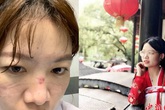 Bác sĩ chống dịch corona ở Vũ Hán: 'Đóng bỉm vì đi vệ sinh là xa xỉ' Bác sĩ chống dịch corona ở Vũ Hán: 'Đóng bỉm vì đi vệ sinh là xa xỉ'