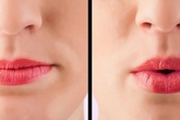 7 cách đơn giản có thể làm tại nhà để tăng cường sức đề kháng cho phổi 7 cách đơn giản có thể làm tại nhà để tăng cường sức đề kháng cho phổi